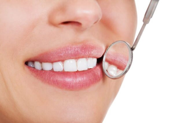 A close up of a woman's mouth with a dental mirror reflecting her teeth