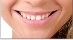 perfect woman's smile resulting from a smile makeover