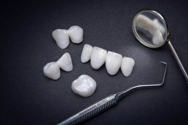dentist at summit family & cosmetic dentistry prepares veneers and dental tools